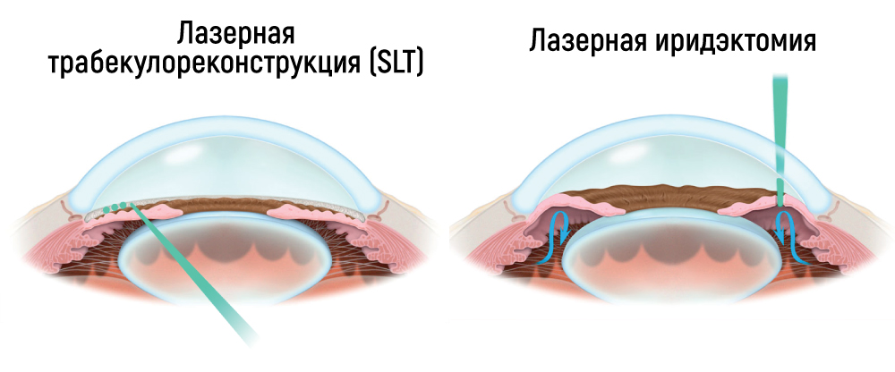 Лечение.jpg